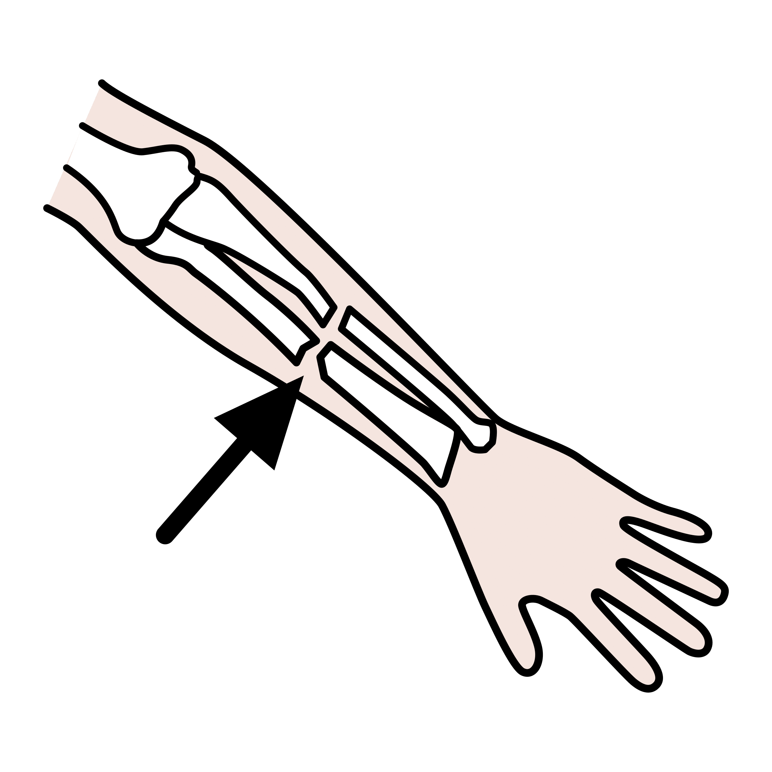 Om man har fått en fraktur i armen eller benet kan man behöva gips. Fraktur betyder att skelettet har gått sönder.