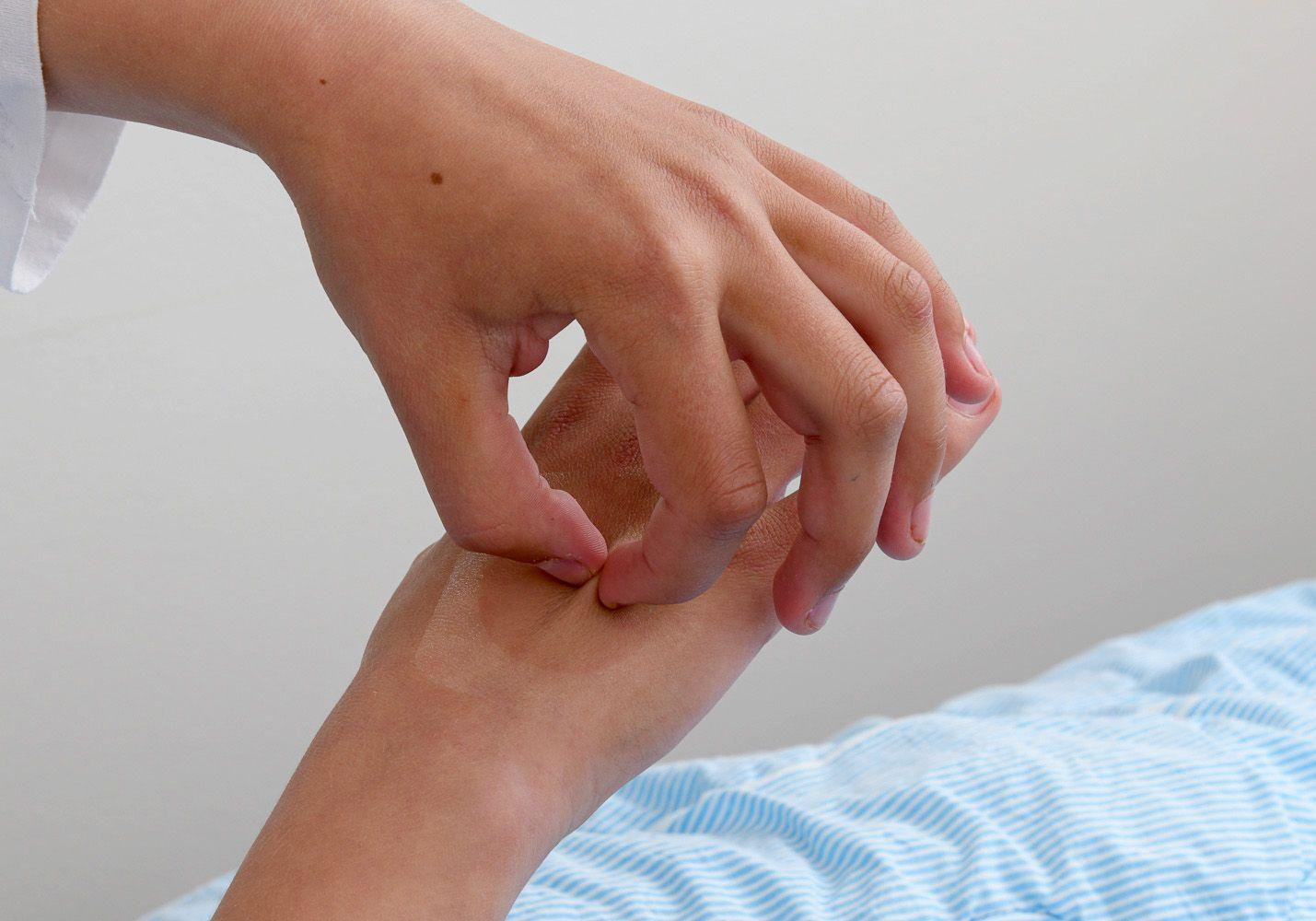 Flicka nyper på sin bedövade hand.