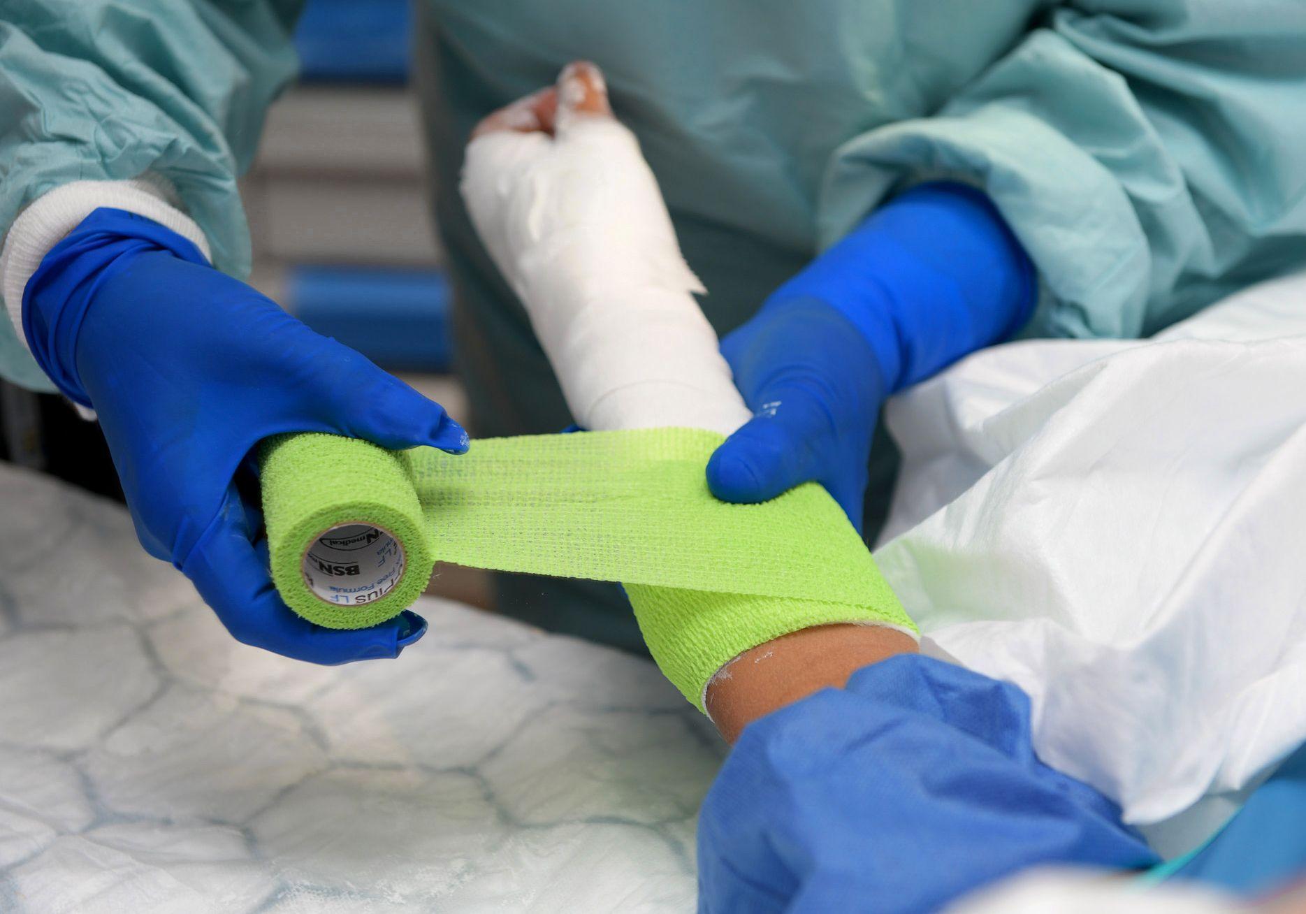 En arm med vitt gips. En grön gipslinda lindas ovanpå det vita gipset.