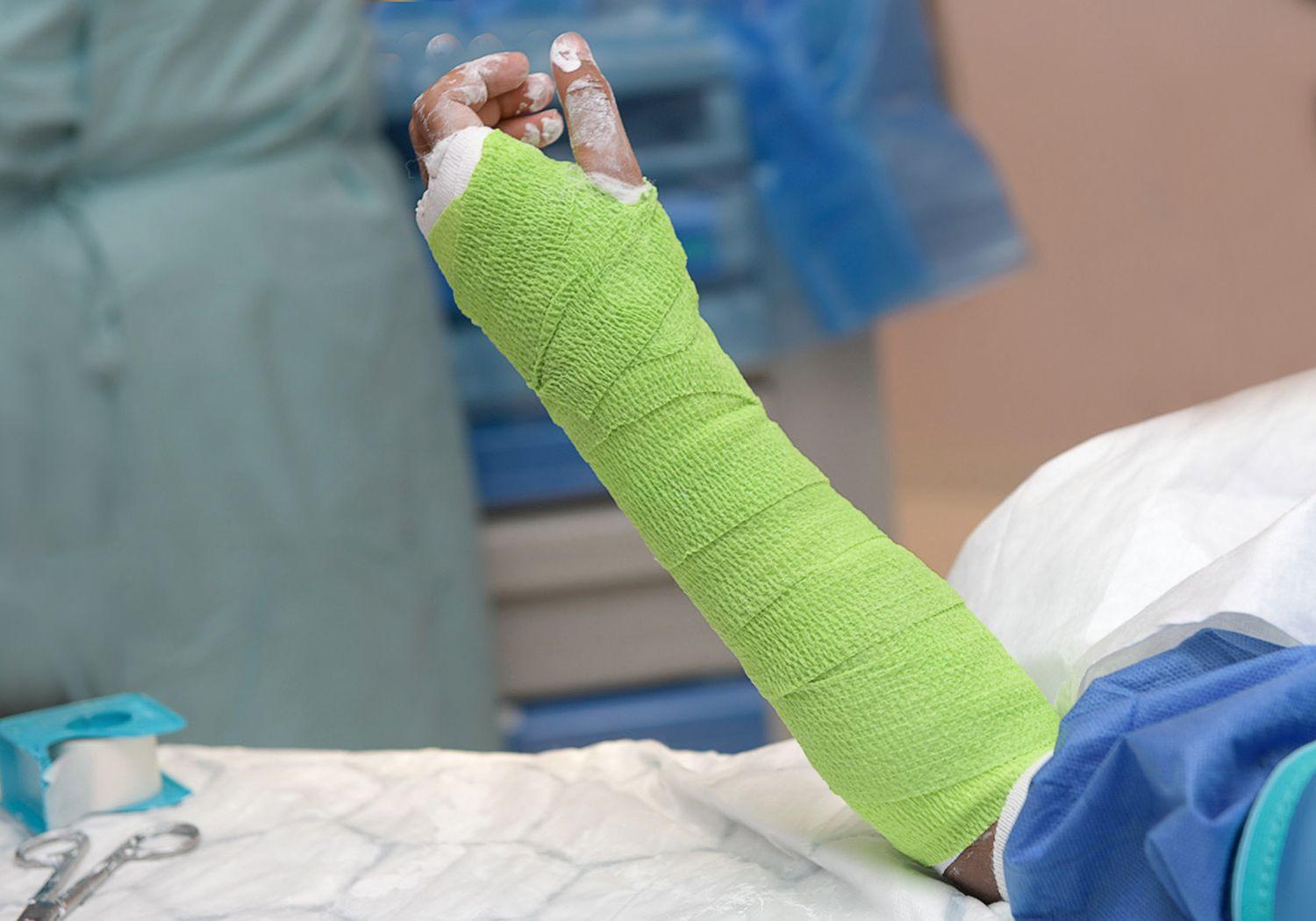 En arm med ett grönt gips.