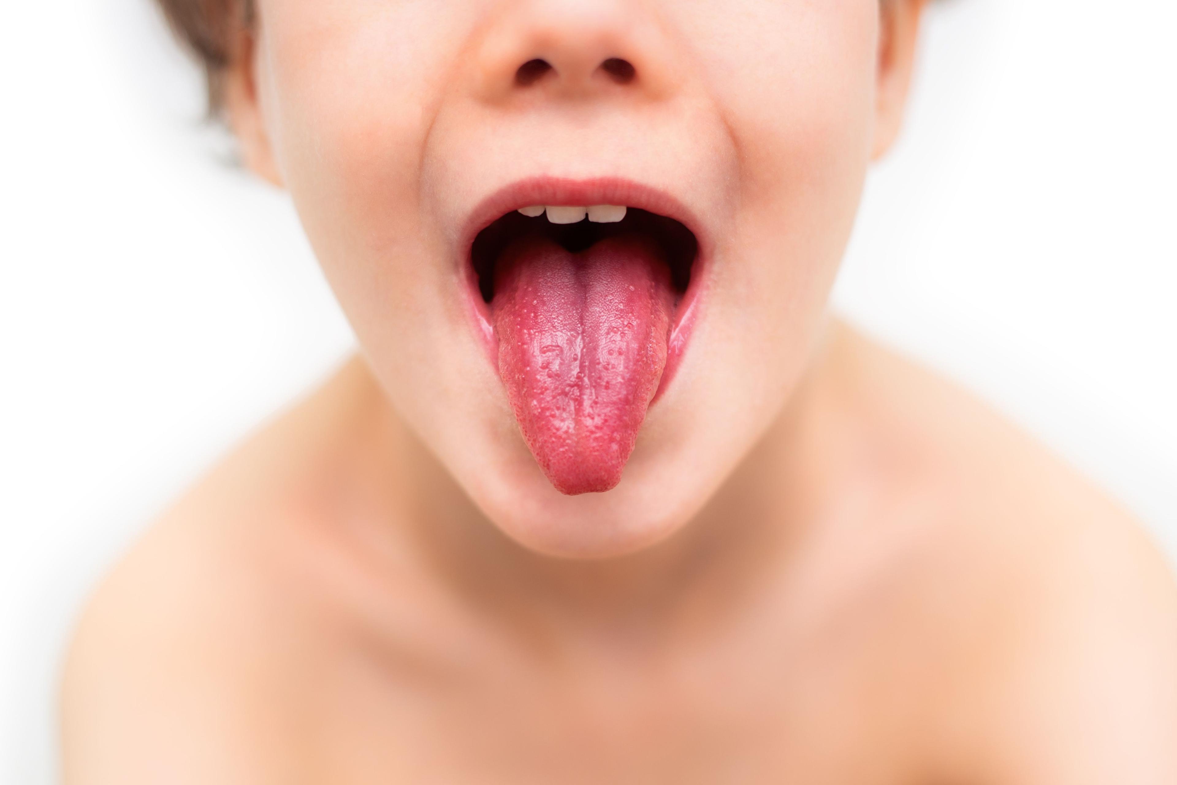 Barn som räcker ut tungan. Tungan är röd och har prickar.