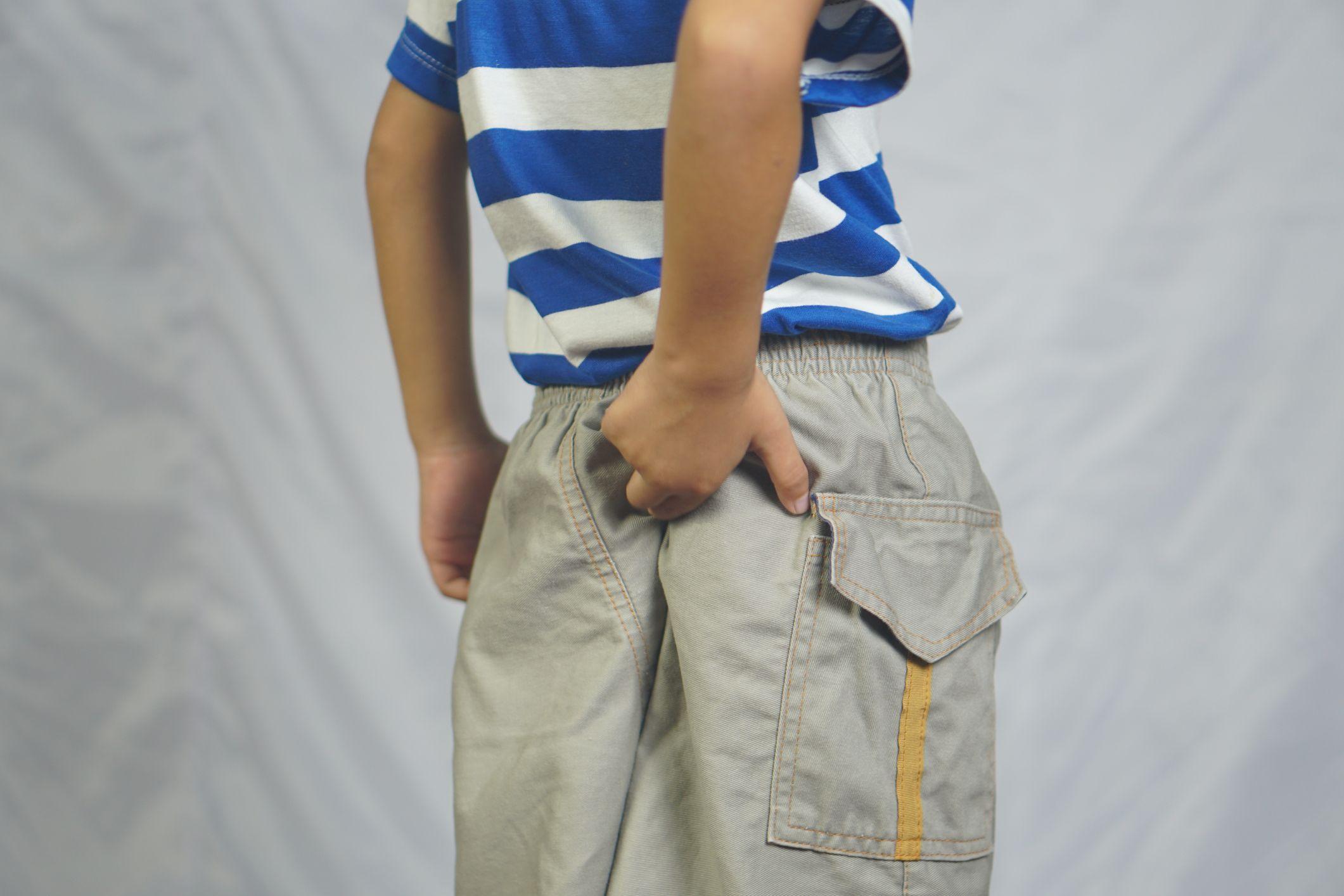 En pojke i en vit- och blårandig t-shirt och beige shorts kliar sig i rumpan.