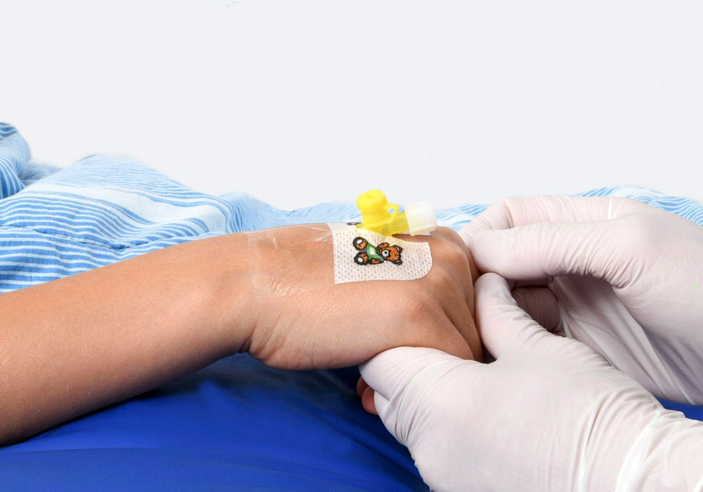En hand med en gul plastslang insatt. Sjuksköterska håller i handen.