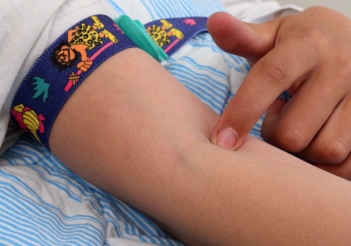 Blodådrorna i Mathildas armveck syns tydligt under huden.
