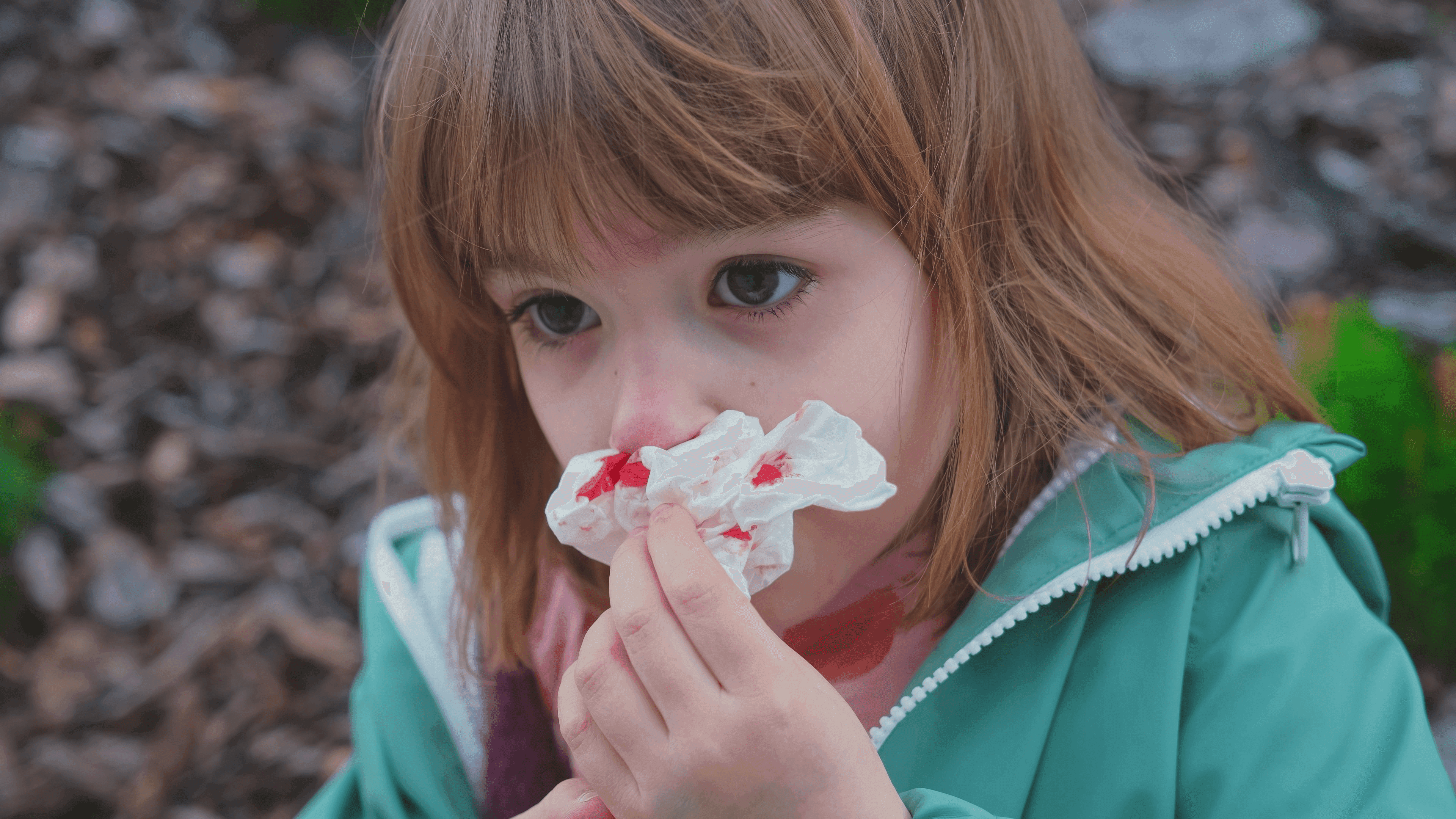 Flicka blöder ur näsan.
