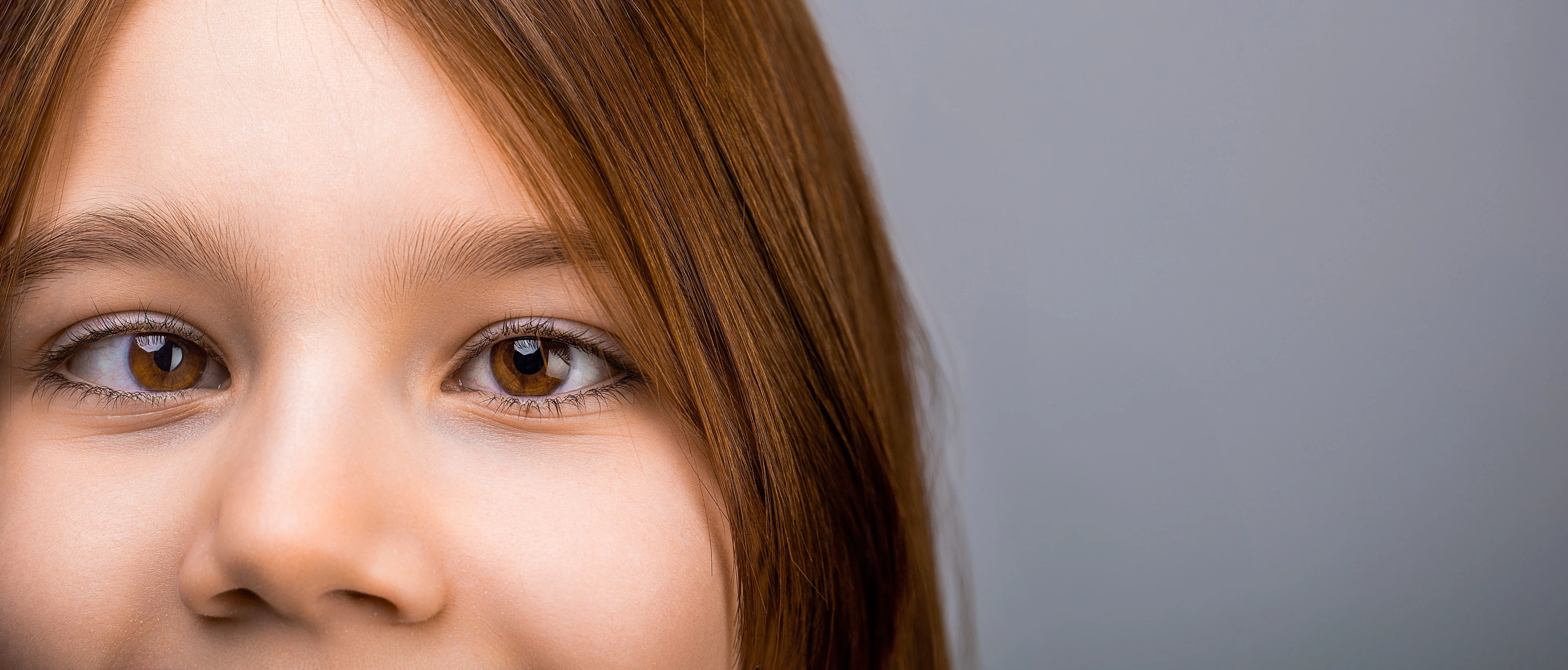 Brunögd flicka som skelar med vänstra ögat.