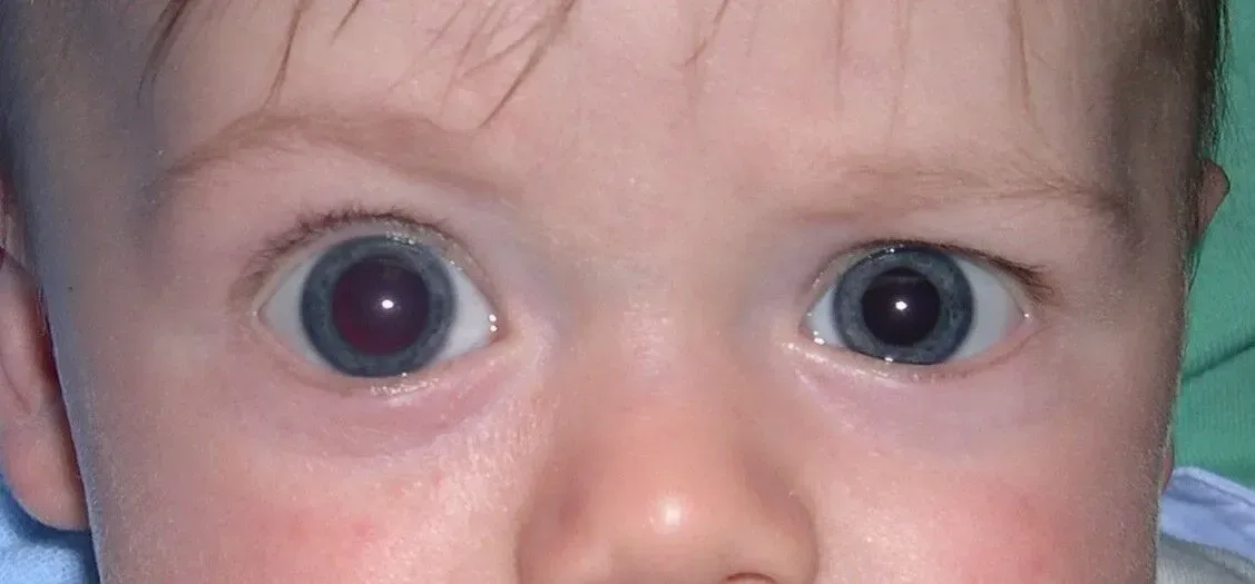 Ett litet barn med stora ögon tittar in i kameran.