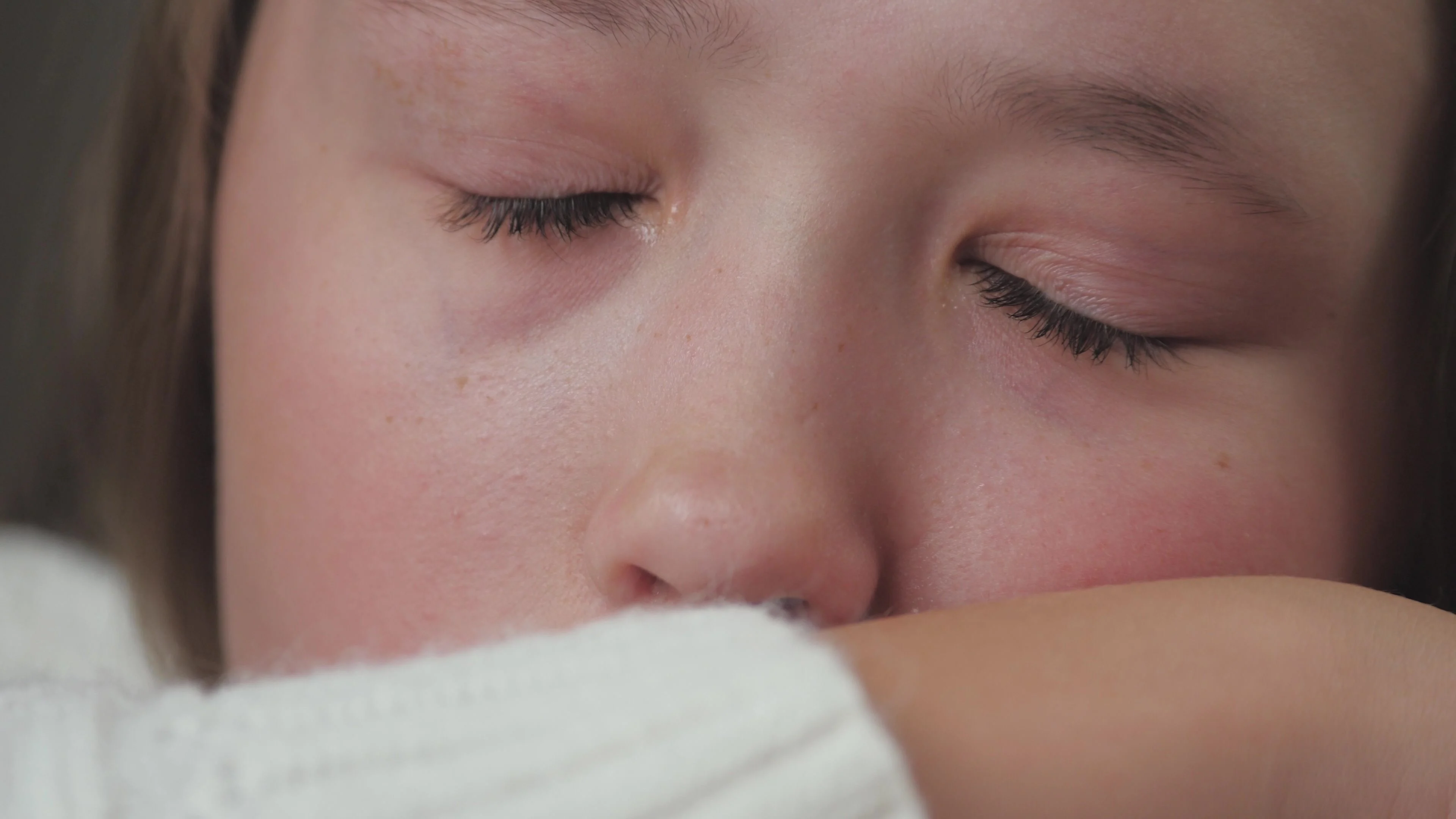 En flicka blundar. Är svullen över ögonen.