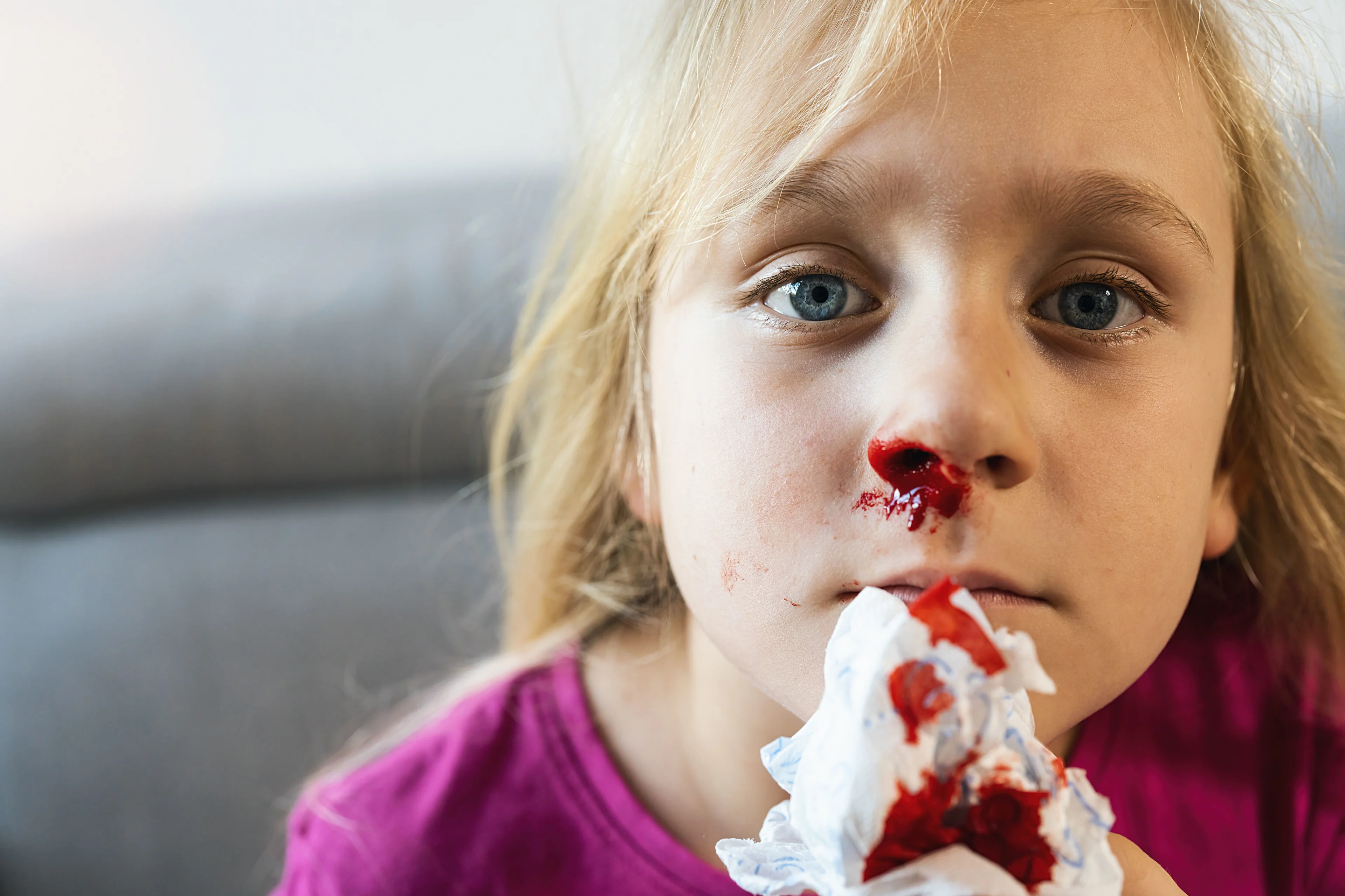 Flicka i ljust hår och lila tröja blöder näsblod.