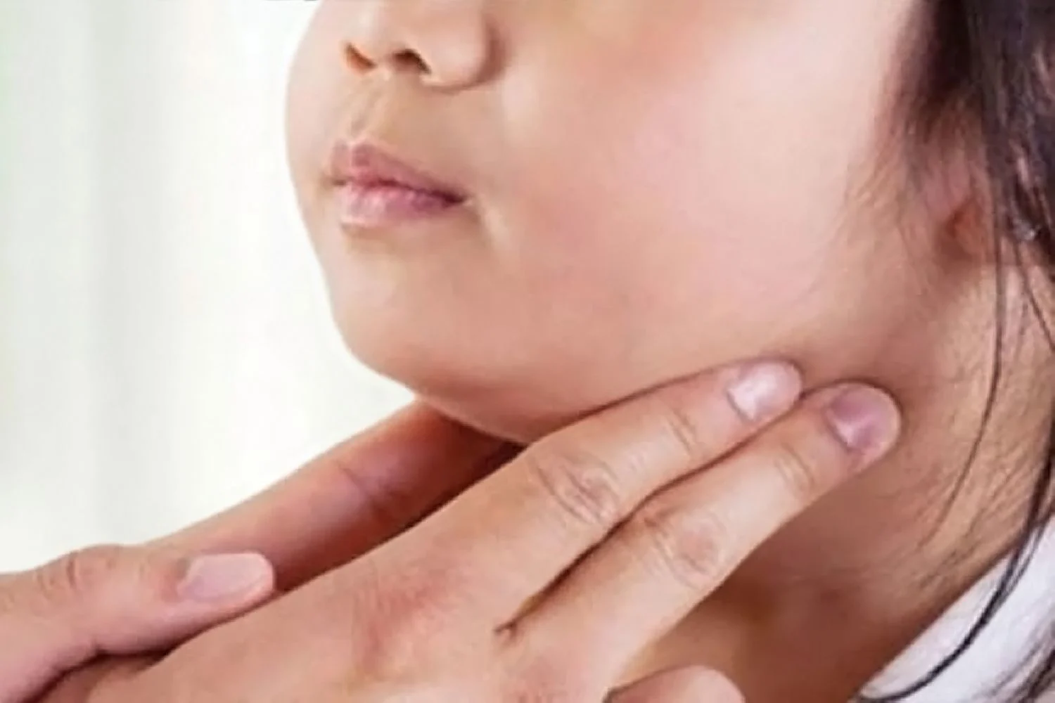 En läkare känner med händerna på en flickas hals. Flickan har en svullnad på halsen.