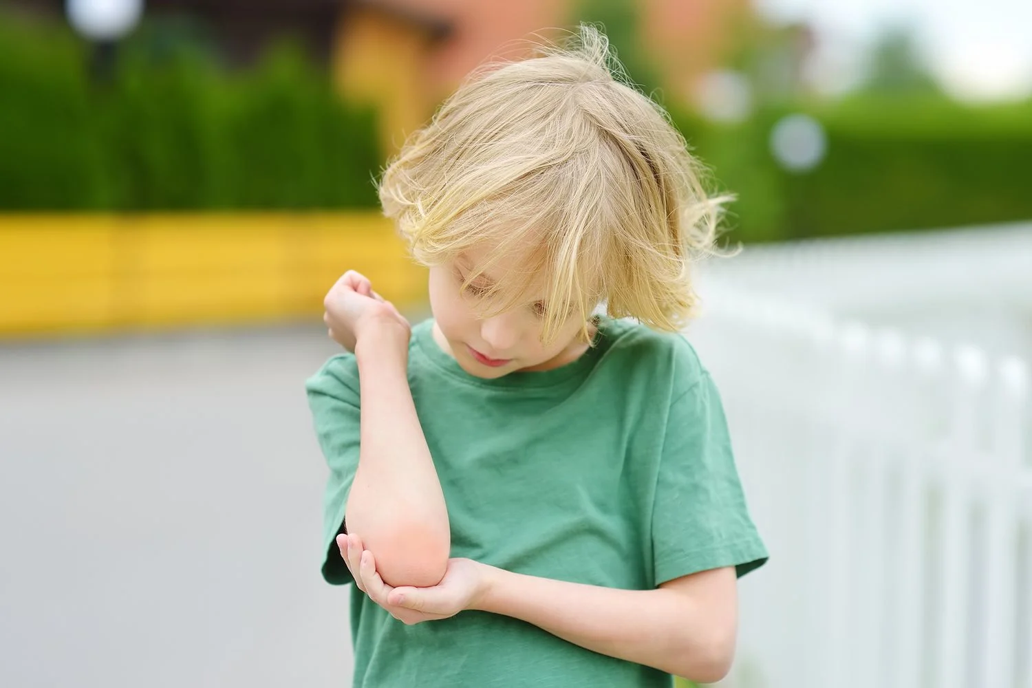 En pojke med ljust hår och i grön t-shirt håller armen böjd. Är röd och svullen över armbågen.