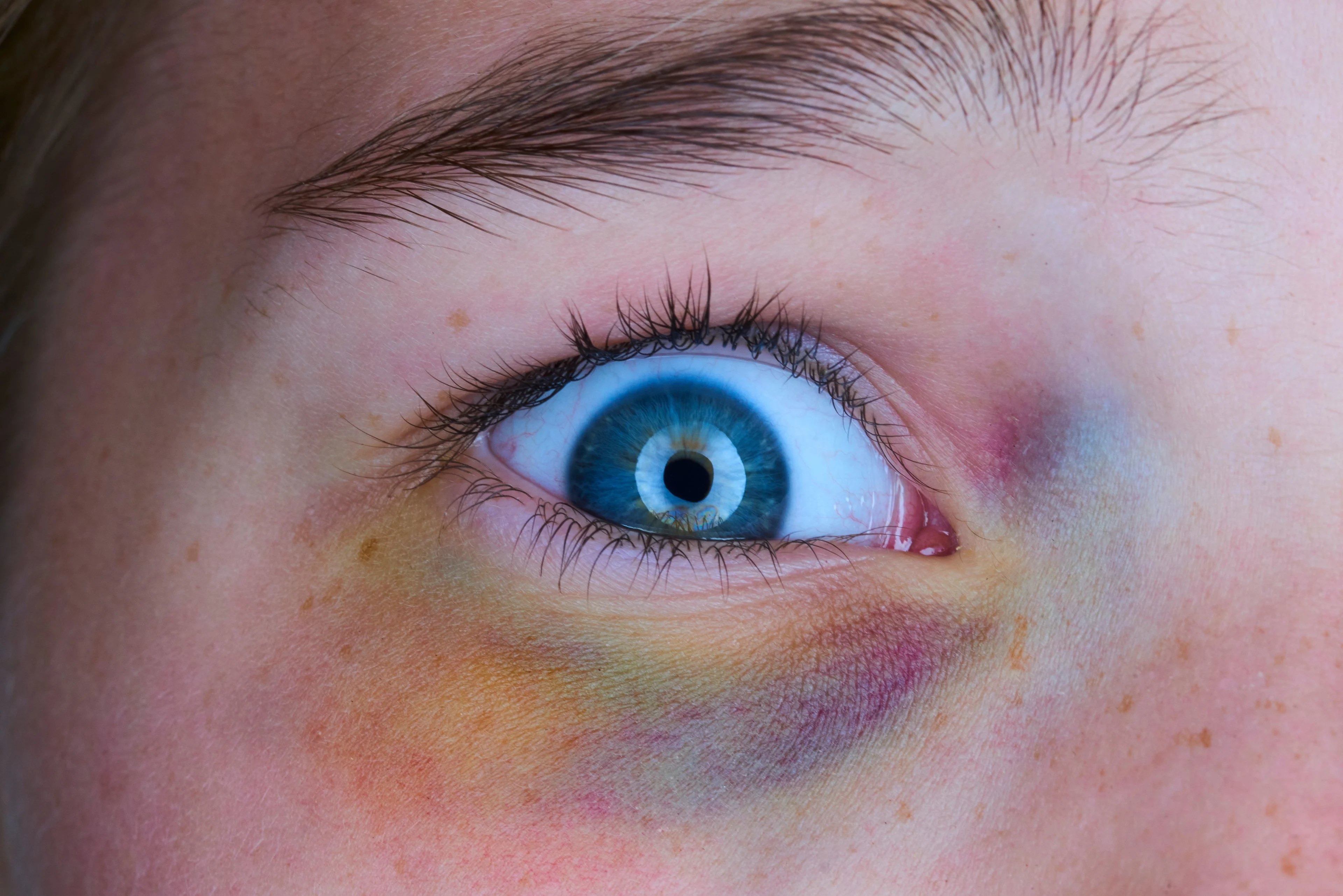 En flicka med många olika färger runt ögat.