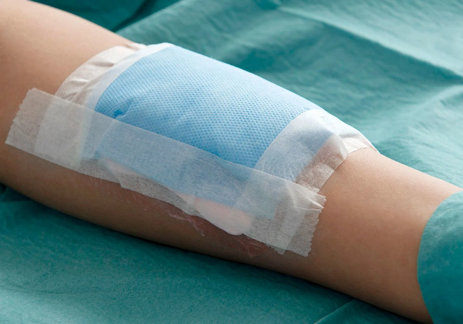 Blått bandage med vit tejp runt om.