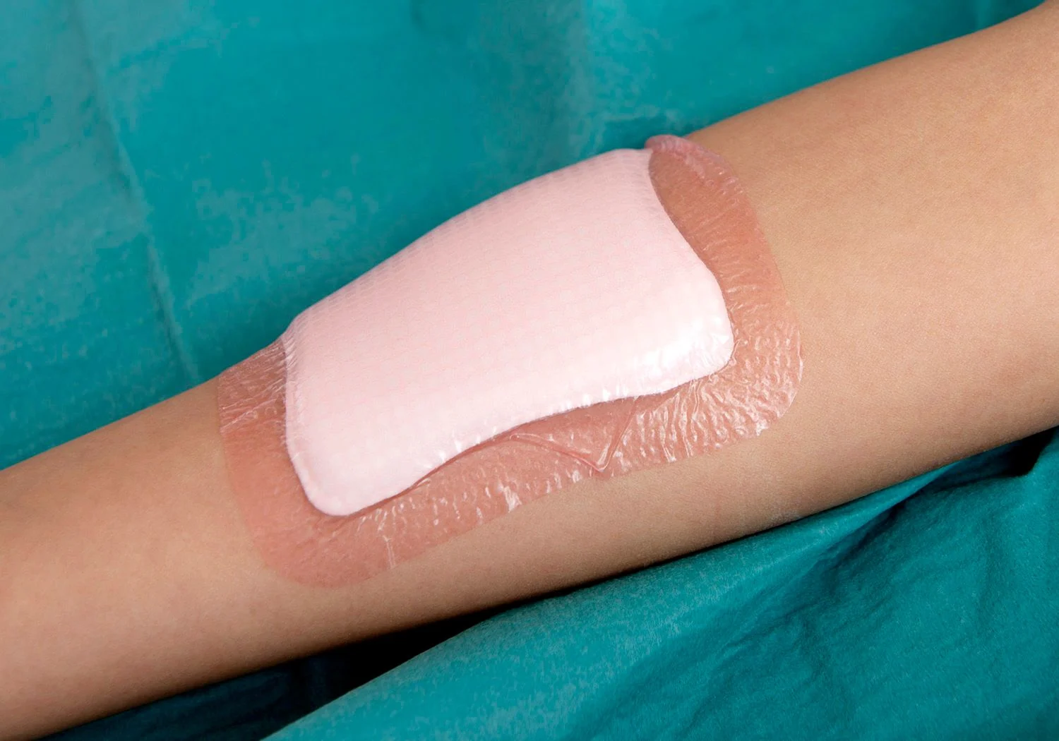 Hudfärgat bandage med kompress under.
