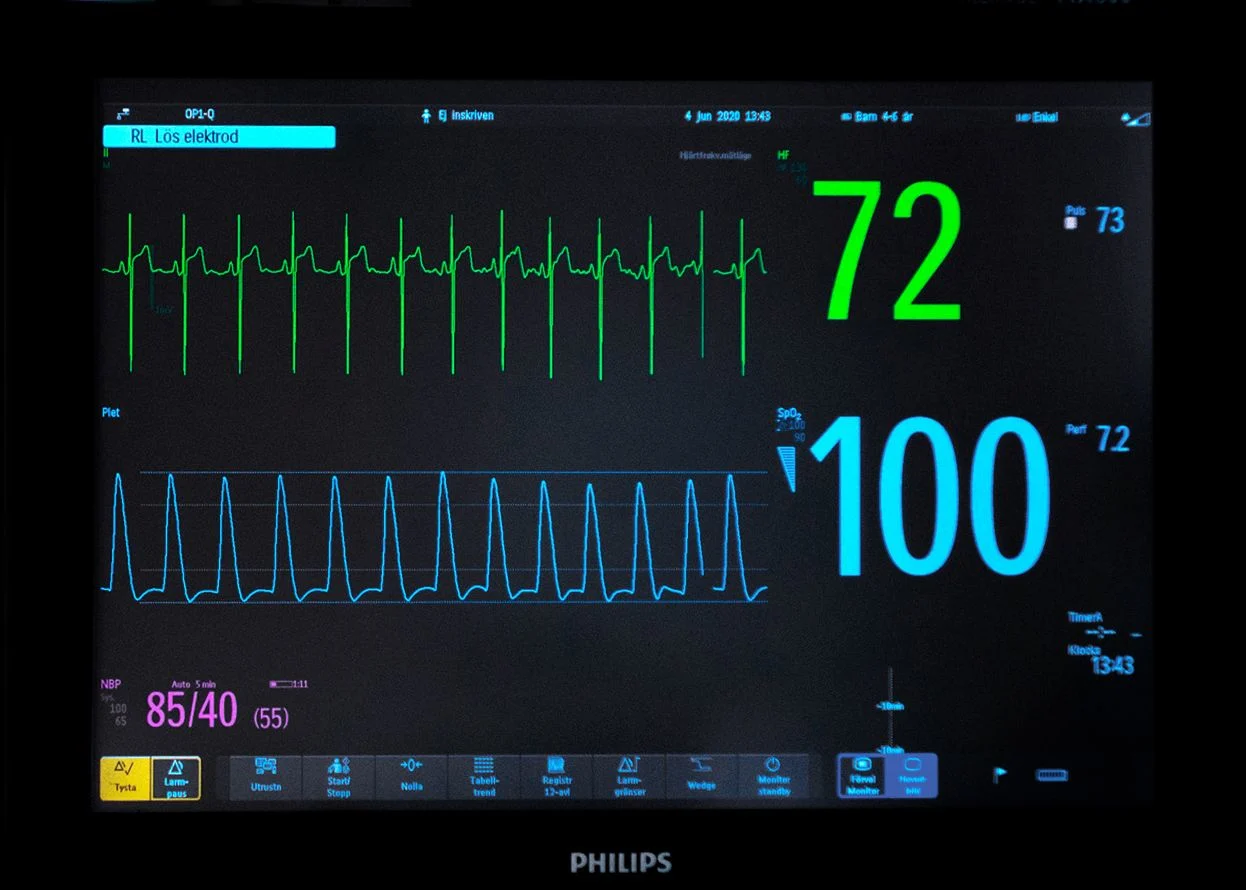 En övervakningsskärm med siffror och kurvor i olika färger.