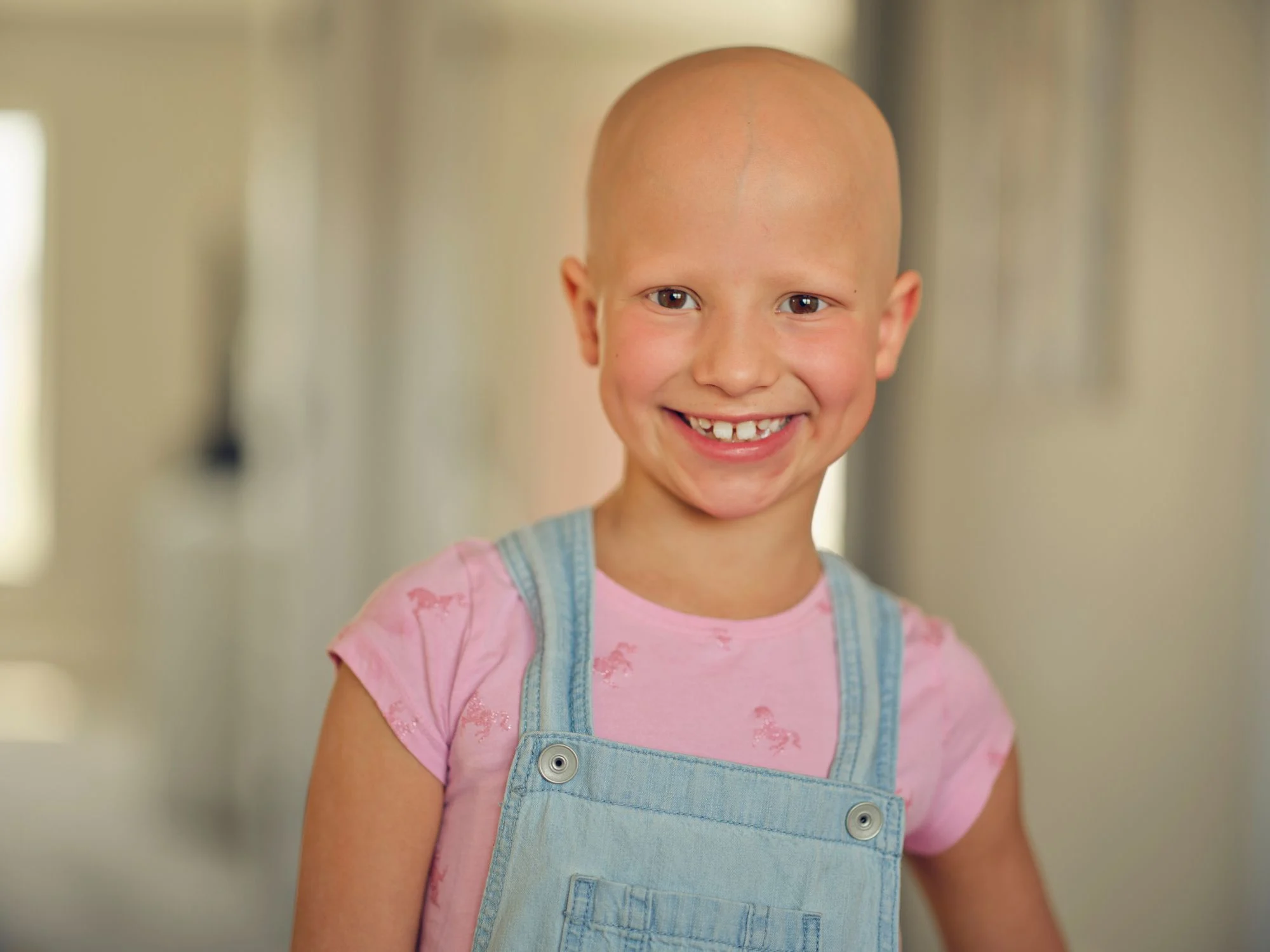 Glad flicka i rosa t-shirt. Flickan har inget hår eller några ögonbryn.