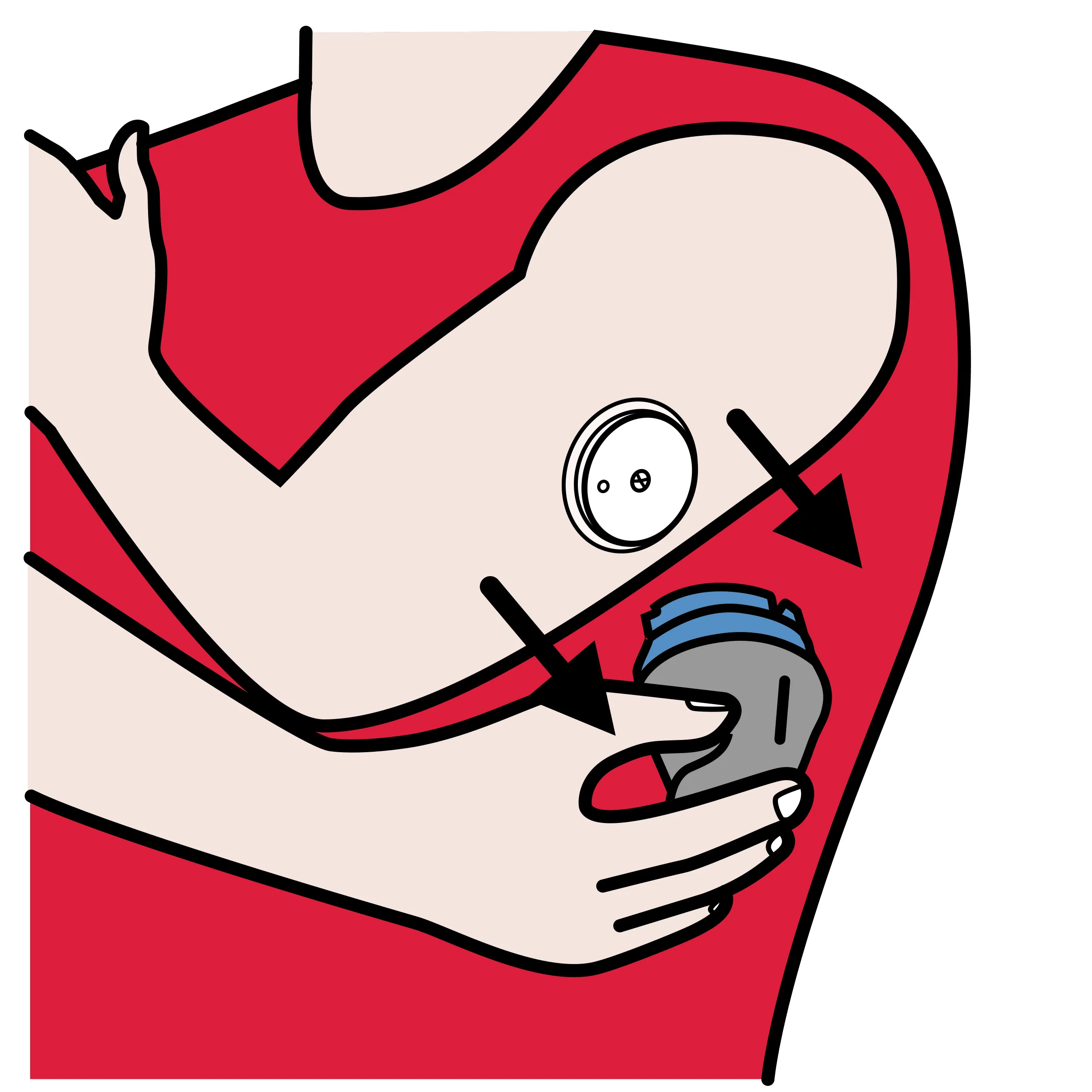 För att pumpen ska veta hur mycket insulin som behövs använder man en sensor. Sensorn sitter på armen. Den mäter hur mycket socker som finns i blodet och skickar information till pumpen.