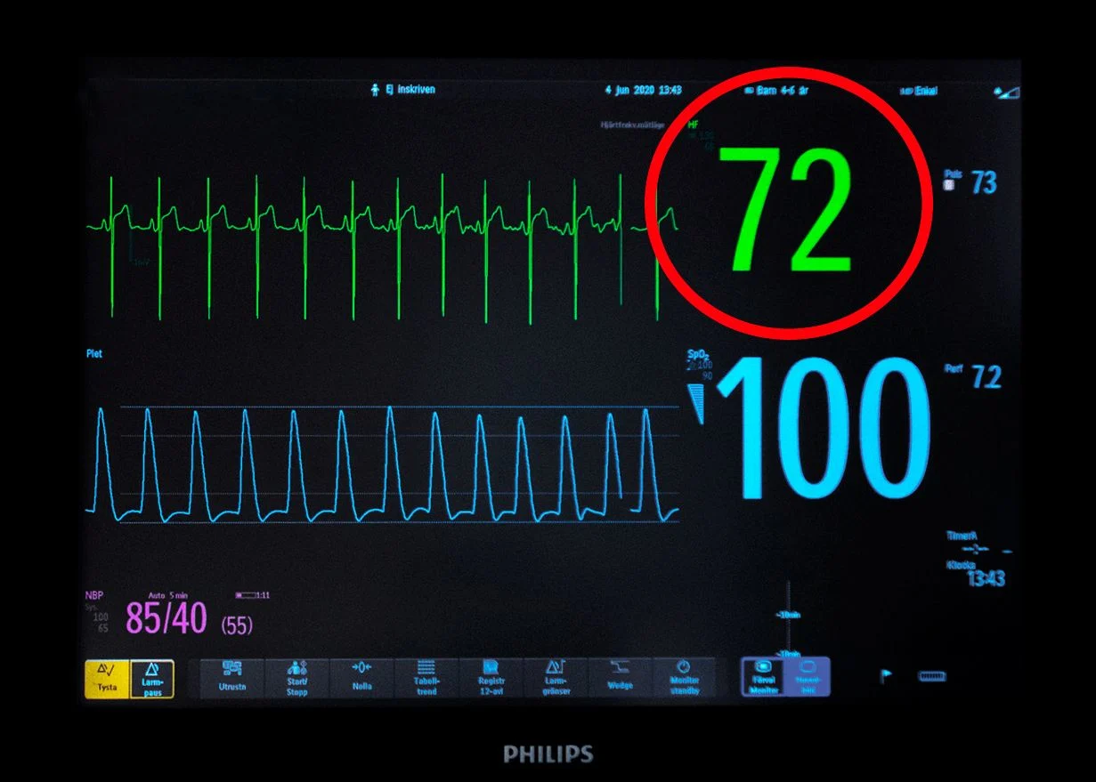 Red String Heart Monitor Cardiac Monitoring | MediPrep
